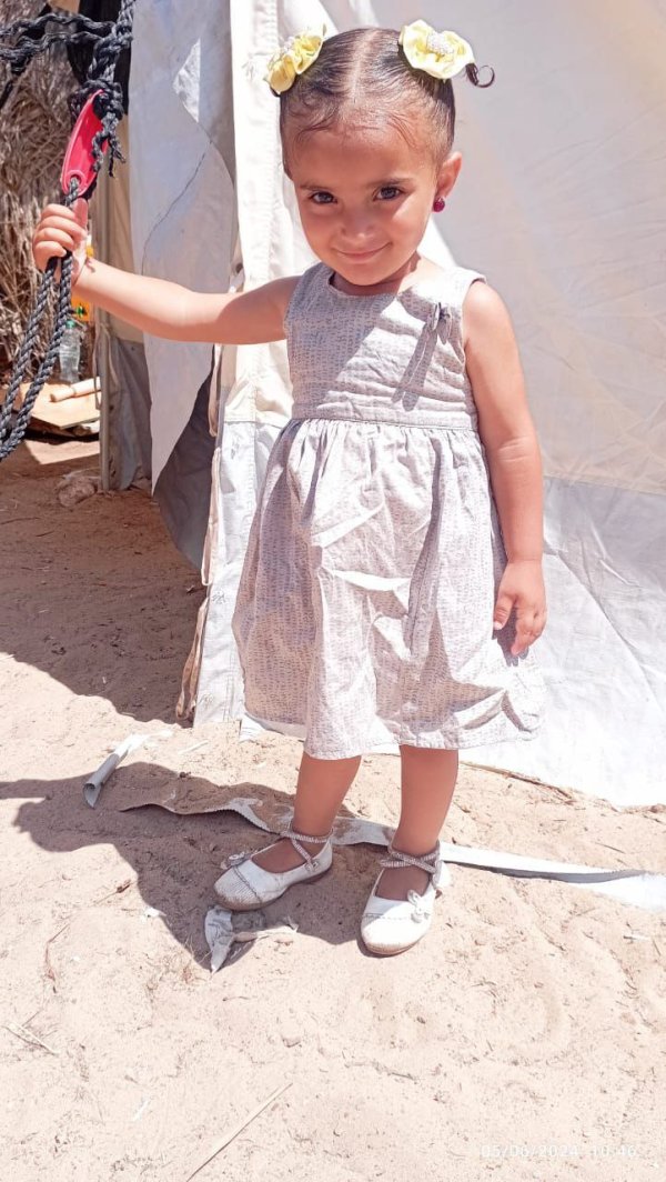 صور الشهيدة الطفلة رغد عبد الله السوسي